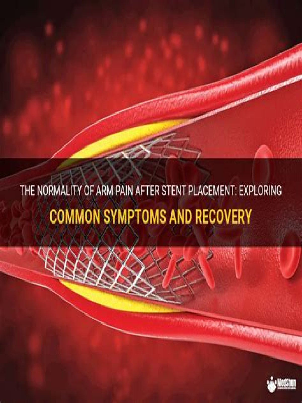 Is it normal to have fever after stent?