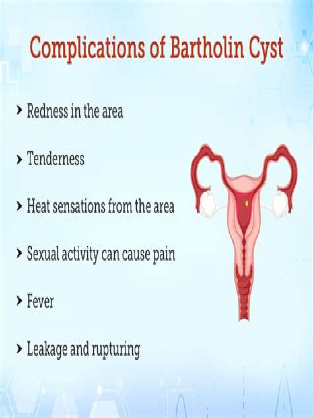 What are the side effects of removing Bartholin gland?